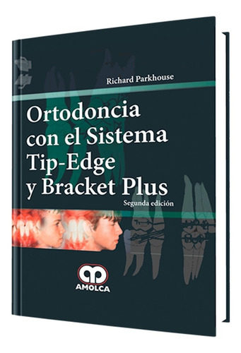 Ortodoncia Con El Sistema Tip-edge Y Bracket Plus.2ª Edición
