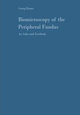 Libro Biomicroscopy Of The Peripheral Fundus - Georg Eisner