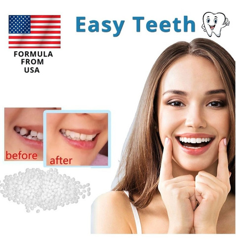 Imagen 5 de 6 de Kit Diente Provisorio Para Reemplazar Un Diente Easy Teeth