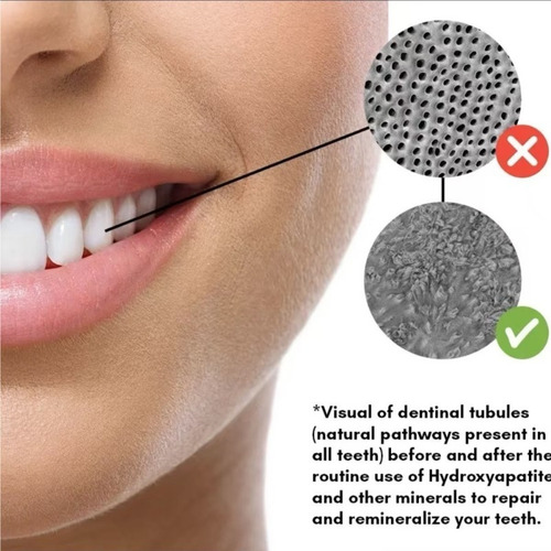 Chicle Remineralizado Underbrush, Bueno Para Los Dientes