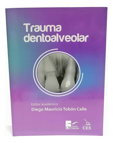 Trauma Dentoalveolar - Diego Mauricio Tobón Calle