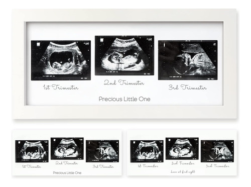 Keababies Sonogram - Marco De Fotos De Ultrasonido Trío Para