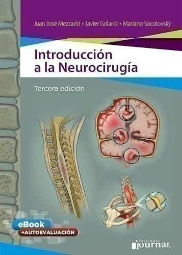Introducción A La Neurocirugía Ed.3º - Mezzadri, Juan José