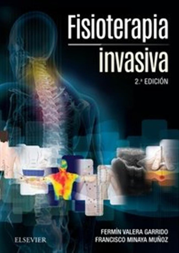 Fisioterapia Invasiva + Acceso Web (2ª Ed,) - Valera, Fermin