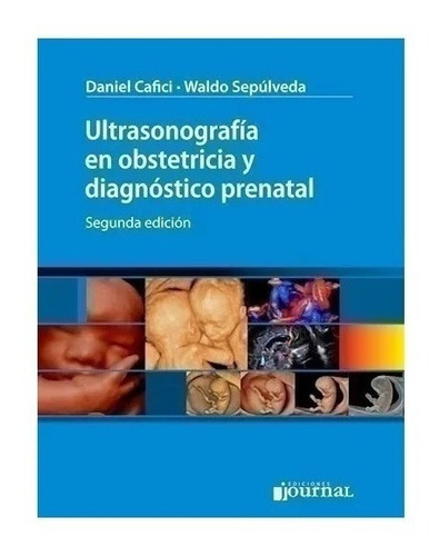 Ultrasonografía Obstetricia Diagnóstico Prenatal 2ed Cafici!