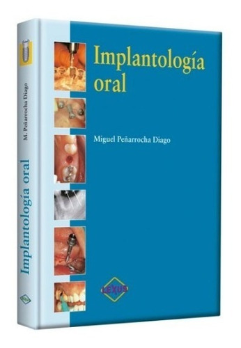 Implantología Oral 