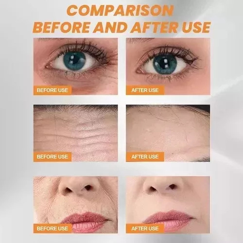 2024 2024 Lámina Soluble En Colágeno Highprime Para Piel