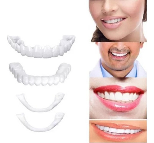 Dientes Cosméticos De Chapa Superior Con Tono Natural, 4 Vec