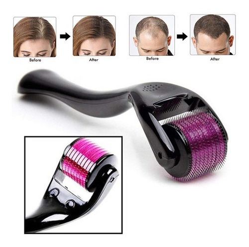 Rodillo Cuero Microneedle 1.5mm Titanio - g a $780