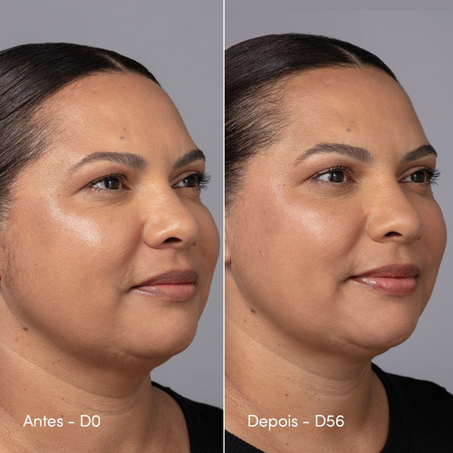 Creme De Contorno Facial Active Pro Bio Colágeno Neo Dermo Momento De Aplicação Dia/noite Tipo De Pele Todo Tipo De Pele