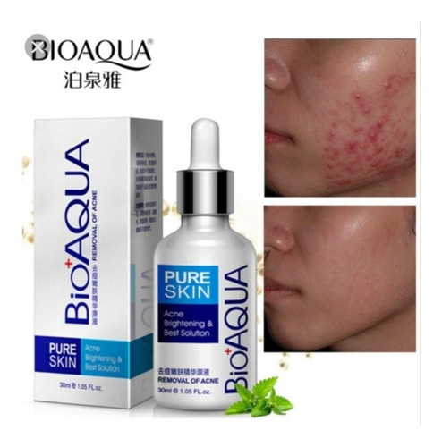 Serum Skin Pure Bioaqua Anti Acne Anti Manchas Puntos Negros