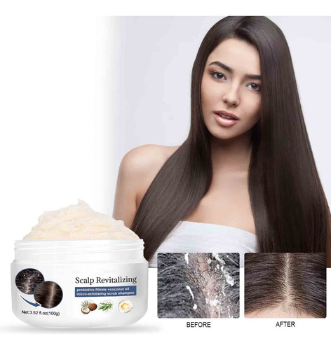 Shampoo De Enxofre Para Controlar A Limpeza De Óleo E Folícu