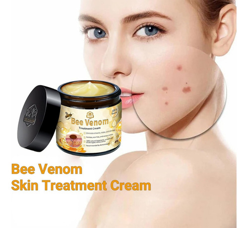 Crema Para El Tratamiento De La Piel De Abeja, Reduce Eficaz