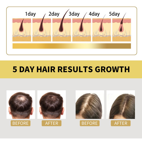 Shampoo Shampoo Para Cabelo 100ml Condicionador Shampoo Nutr