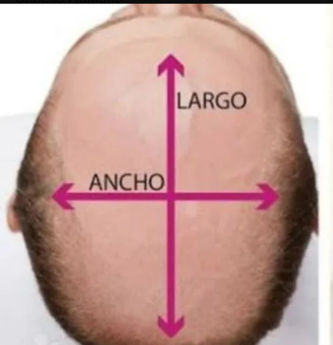 Prótesis Capilar Micro Skin Realmente Indetectable