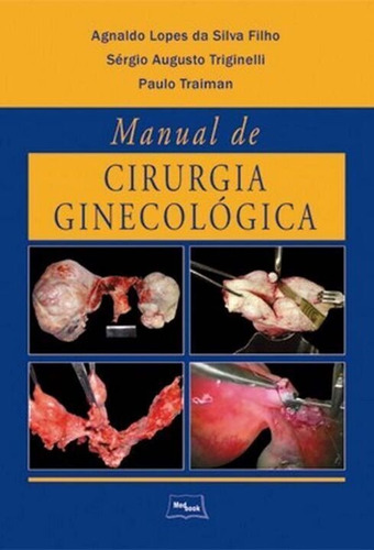 Manual De Cirurgia Ginecologica
