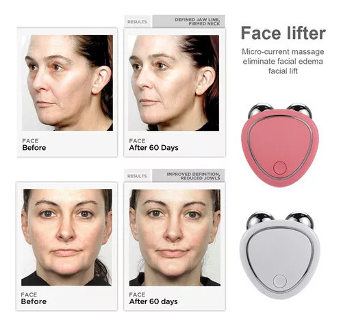 Dispositivo De Estiramiento Facial Usb Con Microcorriente