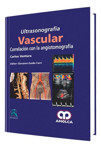 Ultrasonografía Vascular. Correlación Con La Angiotomografía