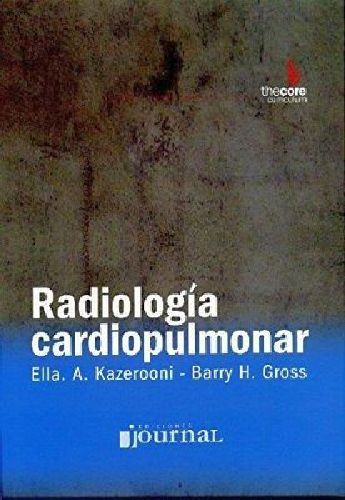 Radiologa Cardiopulmonar, De Kazerooni, Ella. Editorial Ediciones Journal