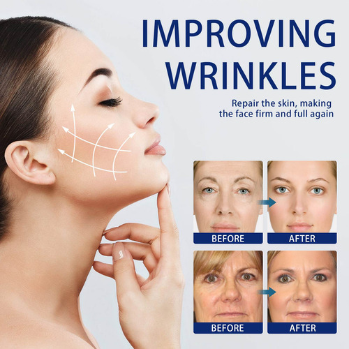 Creme Facial Creme Facial Para Olheiras Creme Facial 50g Dil
