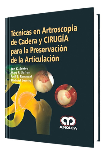 Técn. En Artroscopia De Cadera Y Cirugía Preservación Artic.