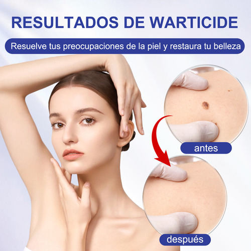 Nekvnro Líquido De Verruga Eliminar Las Verrugas De Manos