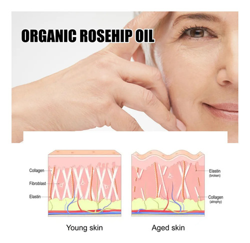 - 4×oil Semilla Frambuesa Roja O Essence B583a Hidrata