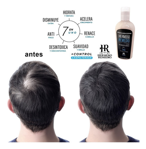Imagen 6 de 10 de Duo Shampoo Crecimiento Anti Caida Reparador Cabello 7 En 1
