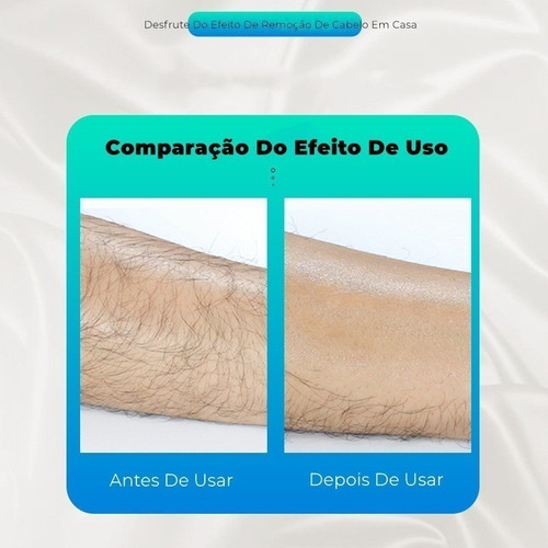 Ferramenta Portátil Sem Dor De Depilação Depiladora Física