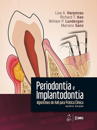 Periodontia E Implantodontia - Algoritmos De Hall Para Prát, De Lisa A. Harpenau Sanz. Editora Santos - Grupo Gen, Capa Mole Em Português