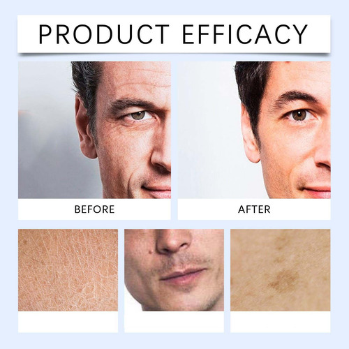 Crema Hidratante Facial X Men, Que Humecta Profundamente Y U