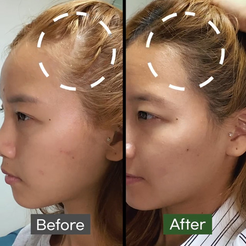 Some By Mi Cica Peptide Anti Hair Loss Spray Caida De Pelo