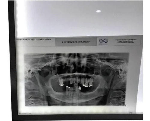 Imagen 2 de 5 de Película Radiografía Kronaline Ke295 Carta 50 Hojas