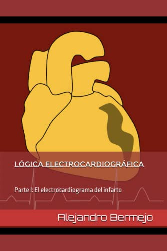 Logica Electrocardiografica: Parte I: El Electrocardiograma