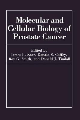 Libro Molecular And Cellular Biology Prostate Cancer : Sy...