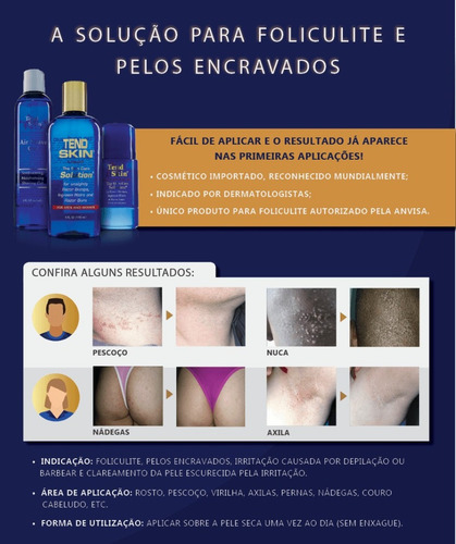 Tend Skin 118ml Loção P/foliculite Pelos Encravados Original