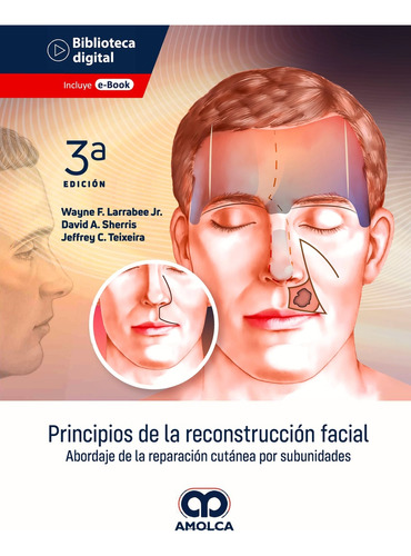 Principios De La Reconstrucción Facial. Abordaje De La Repar