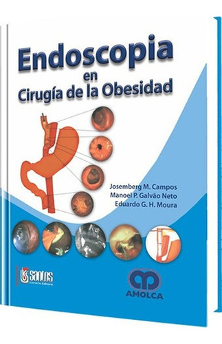 Endoscopia En Cirugía De La Obesidad