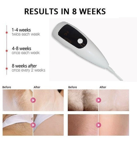 Imagem 3 de 6 de Depilador Laser Luz Pulsada Corporal Removedor Pelos Ipl