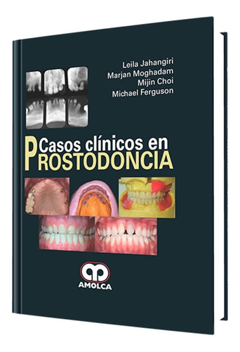 Casos Clínicos En Prostodoncia.  El Libro De Rehabilitación 