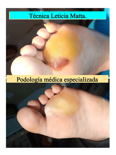 Imagen 7 de 8 de Podologa
