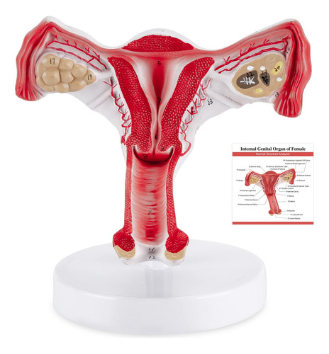 Modelo Anatómico Winyousk Del Aparato Reproductor Femenino