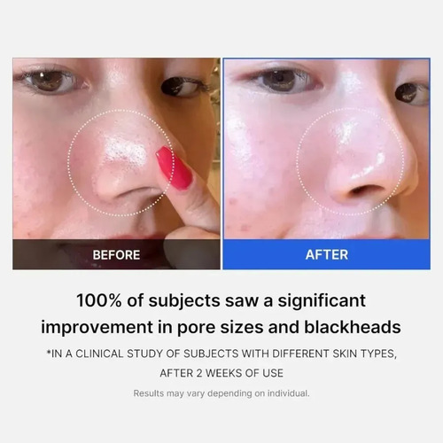 //almohadillas Medicube Zero Pore - Almohadillas Tónicas