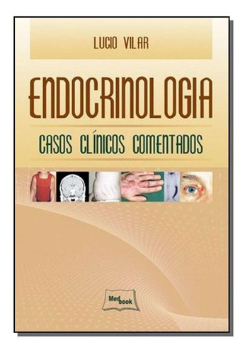 Endocrinologia - Casos Clinicos Comentados