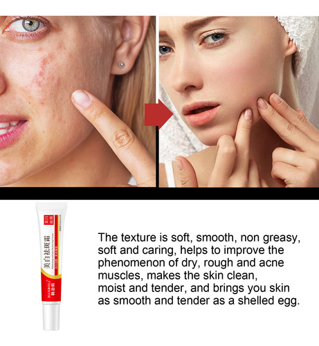 Crema Antipecas G Hidratante Antiarrugas Y Rejuvenecedora C