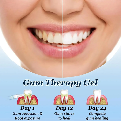 Gel Protector De Las Encías, 3 Geles Para Encías