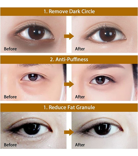 Parches Para Ojos Hidrogel - Parches Para Contorno De Ojos