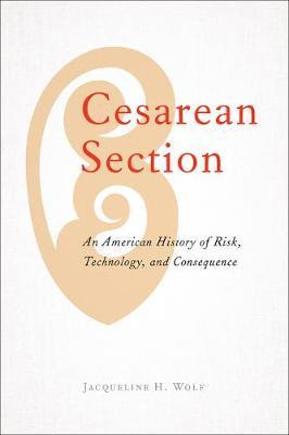 Libro Cesarean Section : An American History Of Risk, Tec...