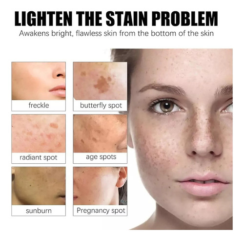 Crema De Urea Y Grasa Que AtenĂșa Las Imperfecciones, Crema D