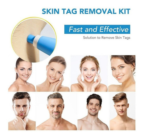 Kit De Eliminación De Piel Lescolton Auto Tag Remover Reloj